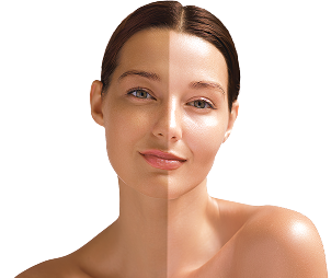 Pomáha vyrovnávať tón pleti a rozjasňovať pokožku.